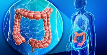 How to Improve Gut Microbiome